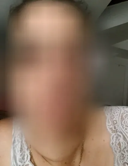 Michelle, 35